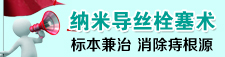 纳米导丝栓塞术 标本兼治 消除痔根源