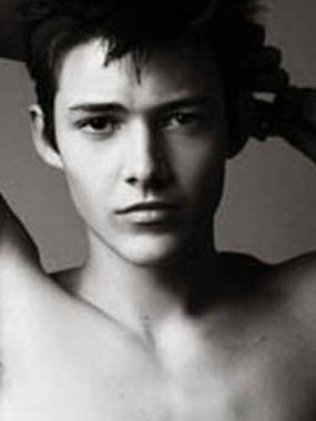 什么人容易出现精子畸形